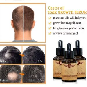 Treatment for Bald Hair Serum Herbal Anti Hair Loss Boosting Hair Growth Oil