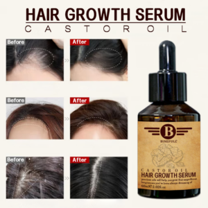 Cruelty Free Hair Growth Oil Kit Hair Growth Serum For Hair Loss Regrowth Ginger Oil
